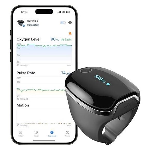 Wellue O2Ring-S Oxygen Monitor with Vibration Reminder